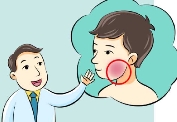 如何预防流行性腮腺炎？